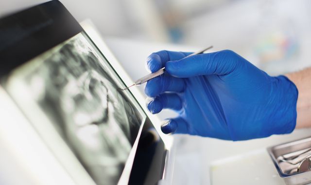 Coronavirus: Dentists warn of looming dental and mouth cancer crisis after months of lockdown measures